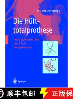 【3-4周达】Die Hüfttotalprothese: Implantationstechnik Und Lokale Komplikationen [9783642639432]