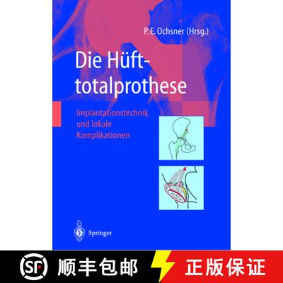 【3-4周达】Die Hüfttotalprothese: Implantationstechnik und lokale Komplikationen [9783642639432]