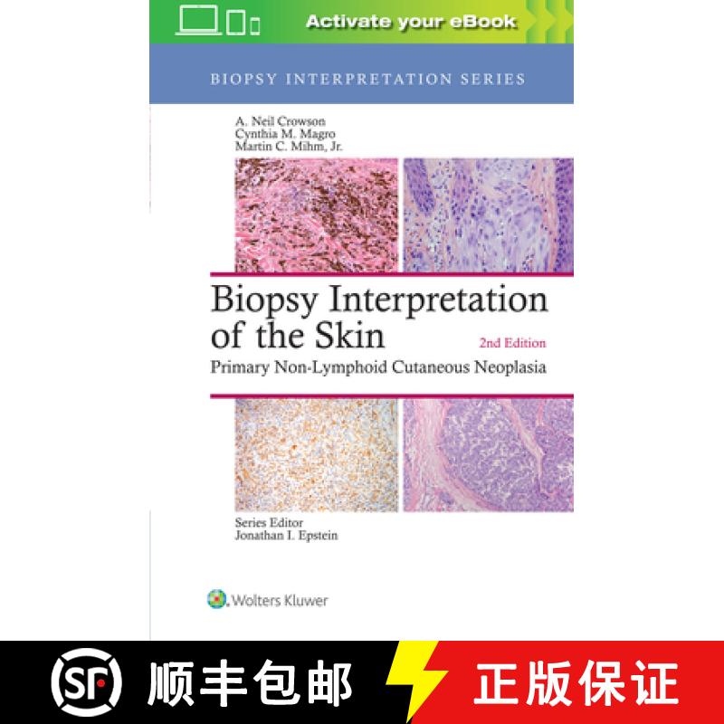 【3-4周达】Biopsy Interpretation of the Skin : Primary Non-Lymphoid Cutaneous Neoplasia [9781496365132]