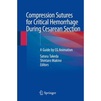 【4周达】Compression Sutures for Critical Hemorrhage During Cesarean Section: A Guide by CG Animation [9789813294622]