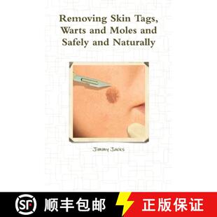 【3-4周达】Removing Skin Tags, Warts and Moles and Safely and Naturally [9781300936664]