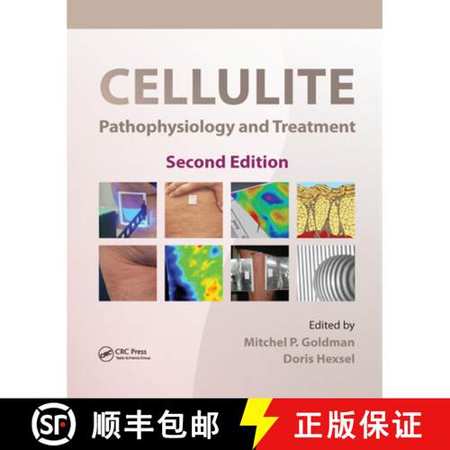 【3-4周达】Cellulite: Pathophysiology and Treatment [9780367384180]