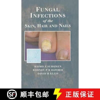 【3-4周达】精装 Fungal Infections of the Skin, Hair and Nails [9781853175893]