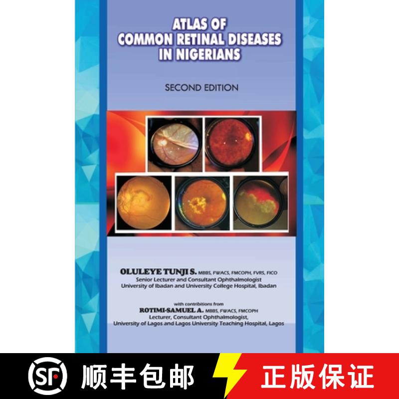 【3-4周达】The Atlas of Retinal Diseases in Nigerians [9789789212088]