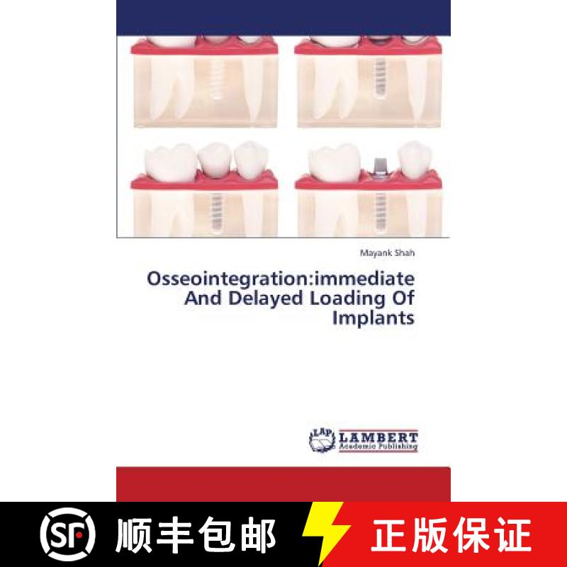 预订 Osseointegration: Immediate and Delayed Loading of Implants [9783659391095]