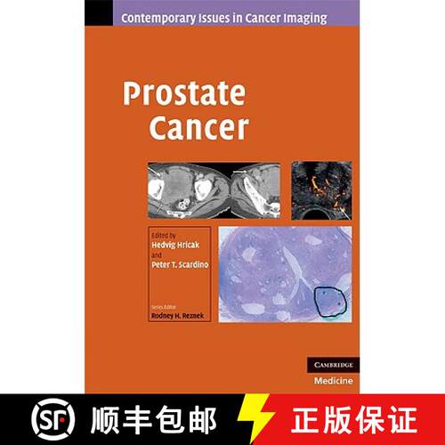 【3-4周达】精装 Prostate Cancer: - Prostate Cancer [9780521887045]