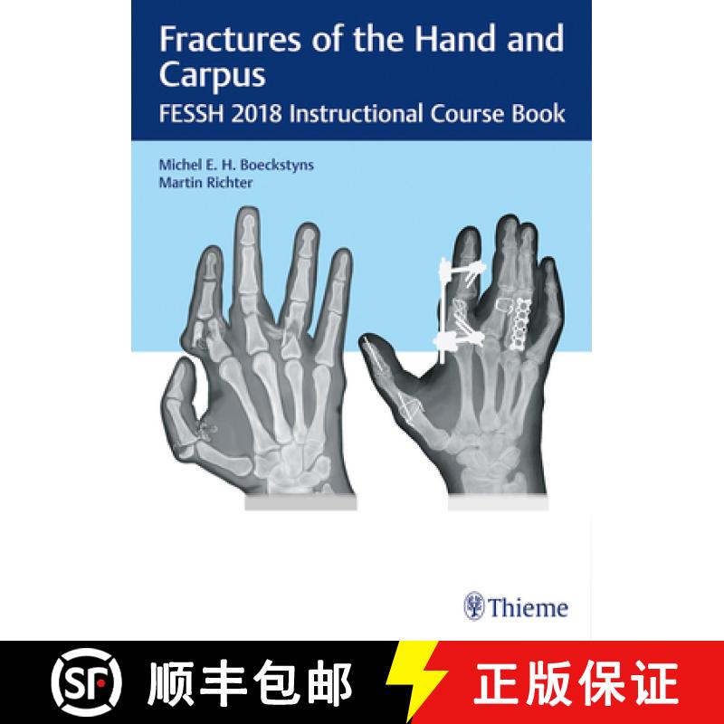 【3-4周达】Fractures of the Hand and Carpus: Fessh 2018 Instructional Course Book [9783132417205]