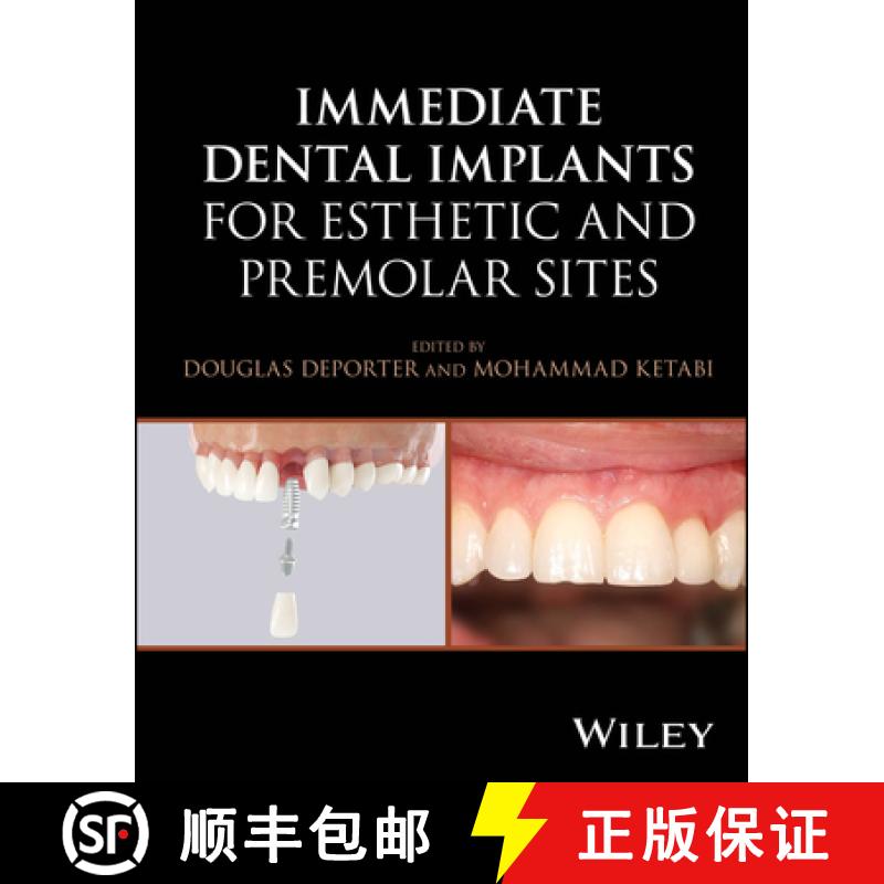 【3-4周达】Immediate Dental Implantation Techniques for Esthe tic and Premolar Sites [9781394187102]