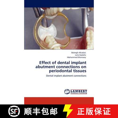 预订 Effect of dental implant abutment connections on periodontal tissues [9783846592953]