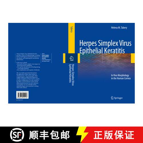 【3-4周达】Herpes Simplex Virus Epithelial Keratitis: In Vivo Morphology in the Human Cornea [9783642010118]