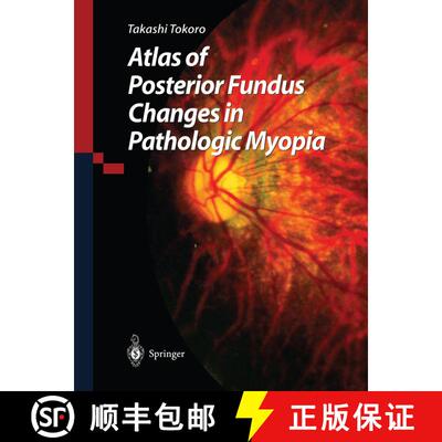 【3-4周达】精装 Atlas of Posterior Fundus Changes in Pathologic Myopia [9784431702252]