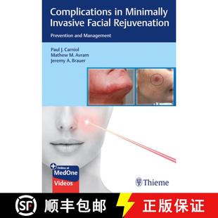 Facial Minimally Rejuvenation Management Complications and 4周达 9781684200139 Prevention Invasive
