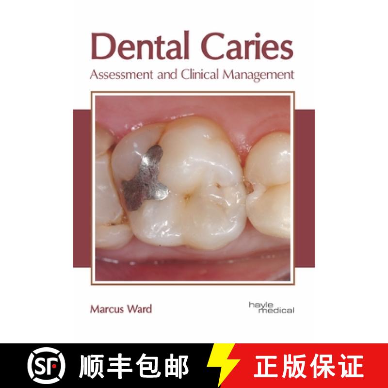 【3-4周达】Dental Caries: Assessment and Clinical Management [9781632415660]