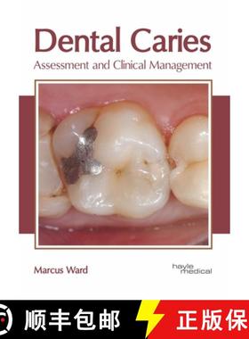 预订 Dental Caries: Assessment and Clinical Management [9781632415660]