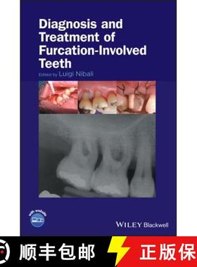 【3-4周达】Diagnosis And Treatment Of Furcation-Involved Teeth [Wiley牙科医学] [9781119270652]