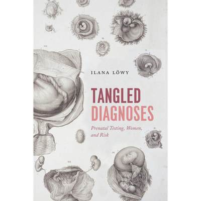 预订 Tangled Diagnoses: Prenatal Testing, Women, and Risk [9780226534121]
