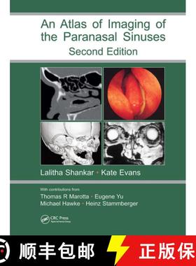【3-4周达】Atlas of Imaging of the Paranasal Sinuses, Second Edition [9781841844480]