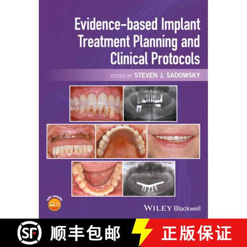 【3-4周达】精装 Evidence-Based Implant Treatment Planning And Clinical Protocols [Wiley牙科医学] [9781119080039]