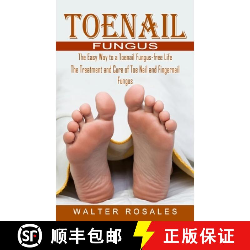 【3-4周达】Toenail Fungus: The Easy Way to a Toenail Fungus-free Life (The Treatment and Cure of Toe ... [9781774854709]