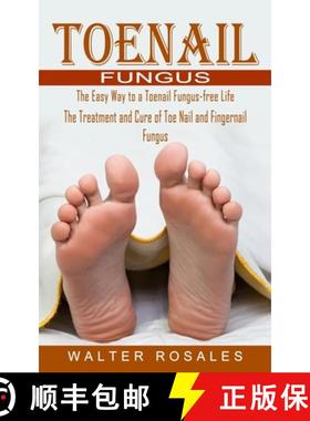 预订 Toenail Fungus: The Easy Way to a Toenail Fungus-free Life (The Treatment and Cure of Toe Nail a... [9781774854709]