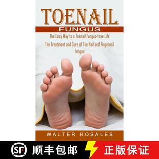 【3-4周达】Toenail Fungus: The Easy Way to a Toenail Fungus-free Life (The Treatment and Cure of Toe ... [9781774854709]