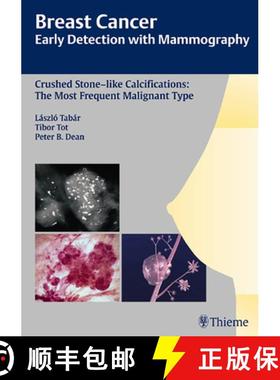 【3-4周达】Breast Cancer: Early Detection with Mammography: Crushed Stone-Like Calcifications: The Mo... [9783131485311]