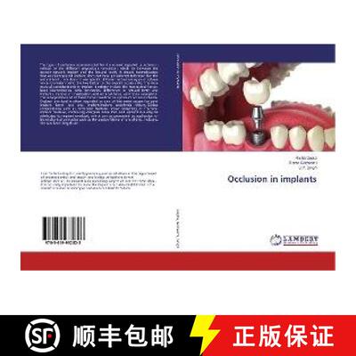 预订 Occlusion in implants [9783659932823]