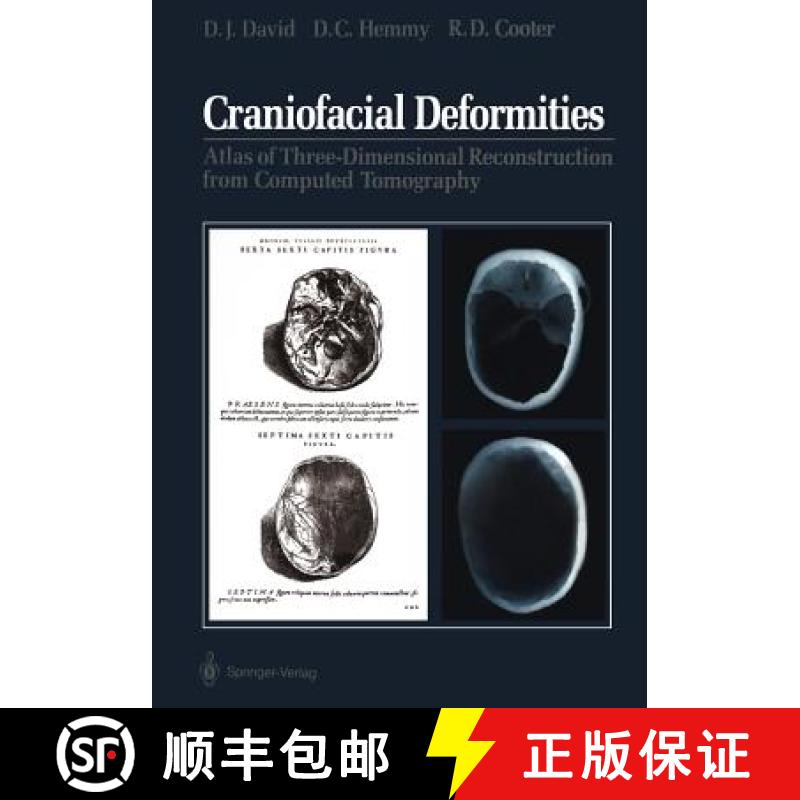 【3-4周达】Craniofacial Deformities: Atlas of Three-Dimensional Reconstruction from Computed Tomography [9781461279266]