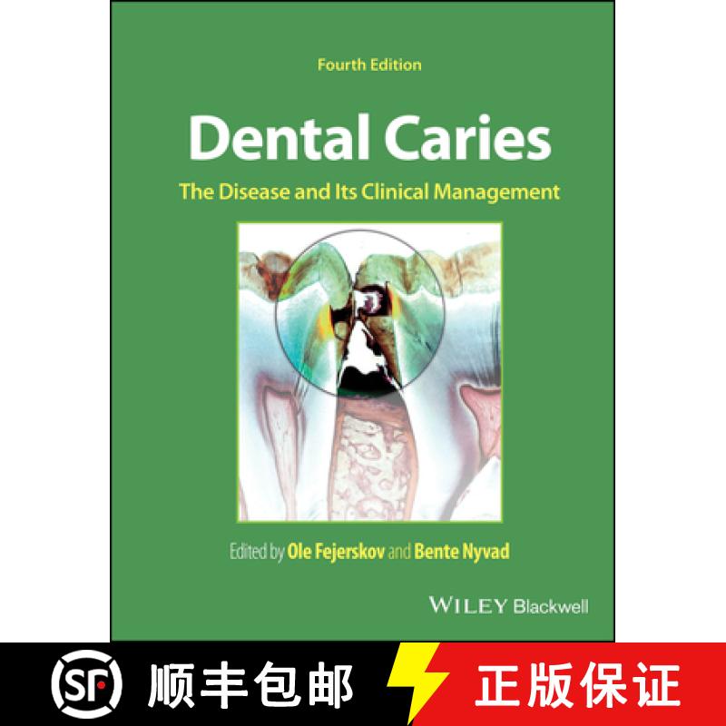 【2-3周达】Dental Caries: The Disease and its Clinical Manage ment 4th Edition [9781119679370]