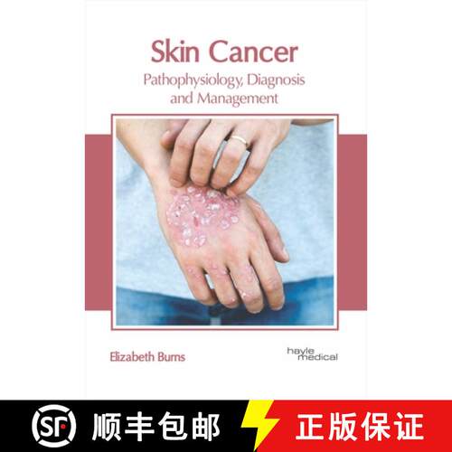【3-4周达】精装 Skin Cancer: Pathophysiology, Diagnosis and Management [9781632416957]