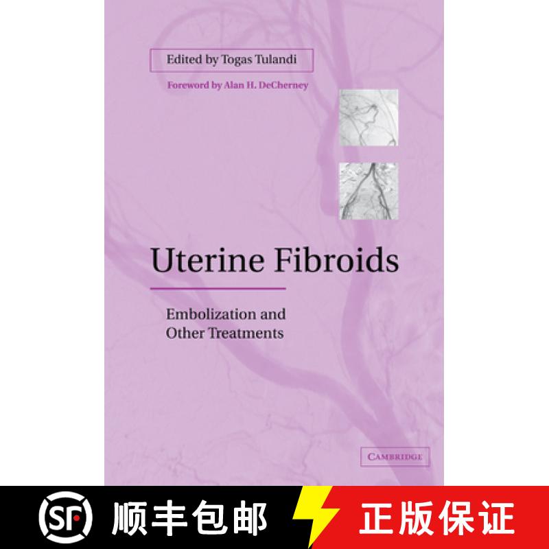 【3-4周达】Uterine Fibroids: Embolization and Other Treatments [9780521184199]