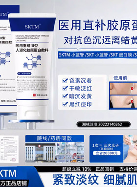 SKTM小蓝管暗沉发黄痘印三型胶原蛋白修复膜SKT蛋白膜SKT