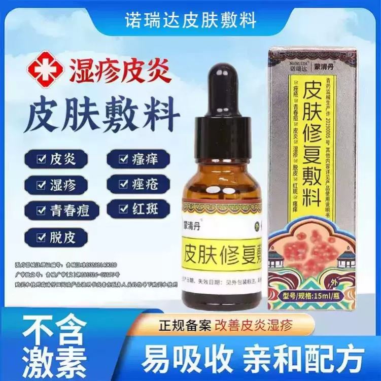 蒙清丹诺瑞达皮肤修复敷料适用于皮焱湿珍青春痘脱皮红斑痒正品