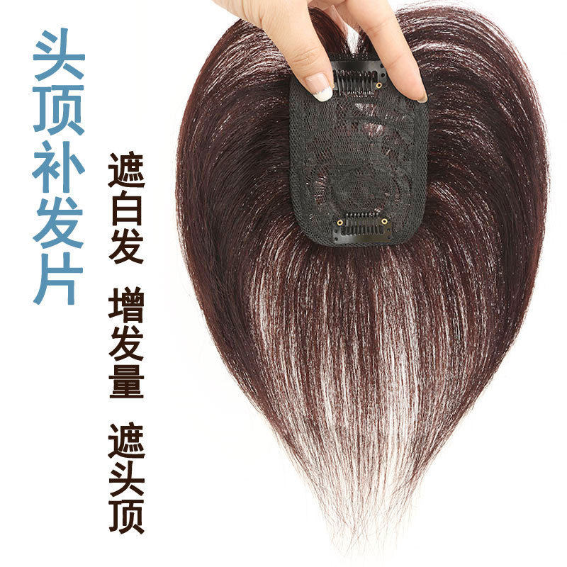 全真发头顶补发块遮白发新款隐形
