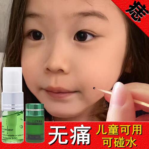 志水无痕药水正品脸部斑点痦子雀斑点除黑志温和不留疤美容院同款