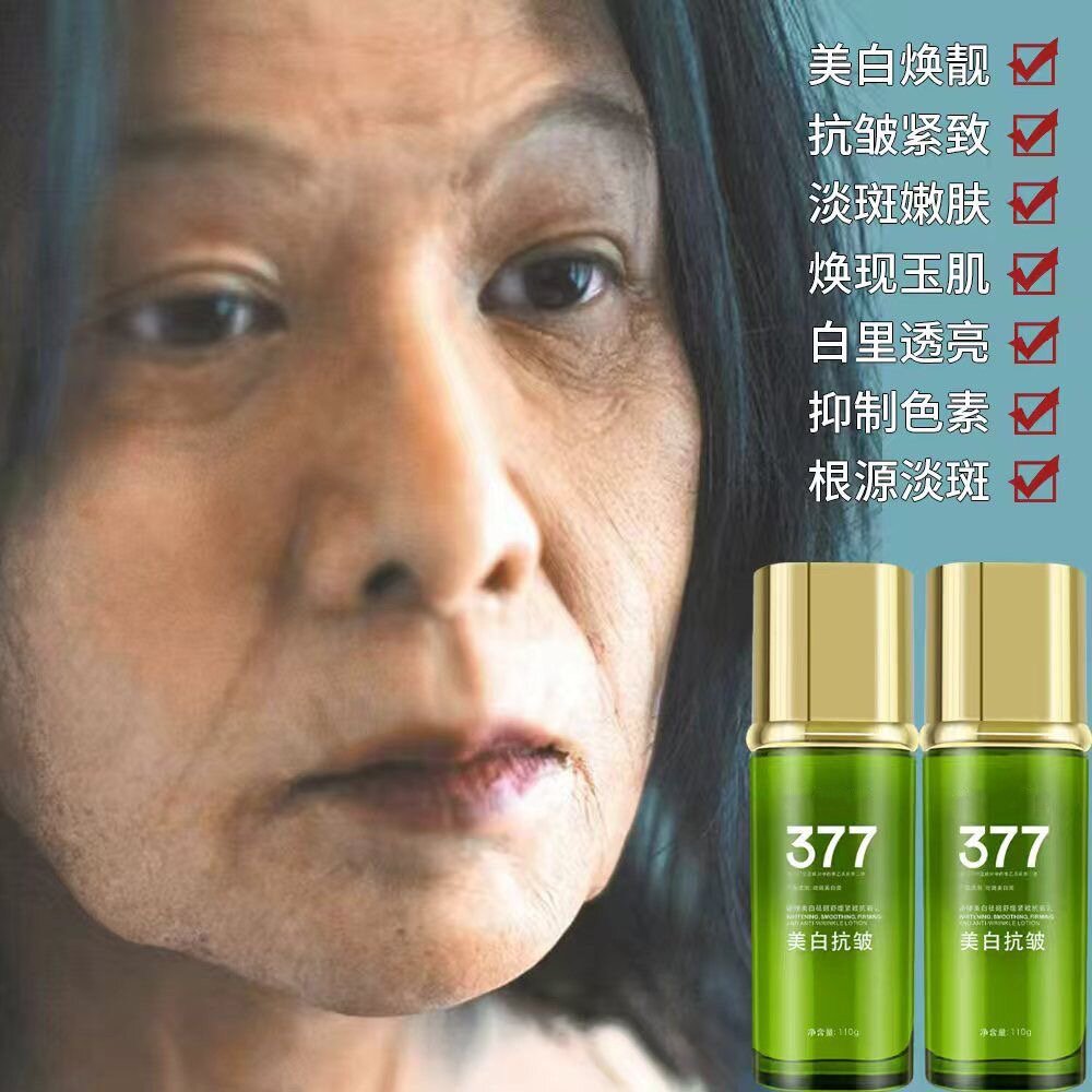 377美白祛斑套装妈妈专用去黄褐斑雀斑补水保湿改善暗黄提亮女士