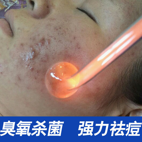 高周波电疗臭氧祛痘美容仪器红光杀菌去痘痘神器脸部电疗棒去粉刺