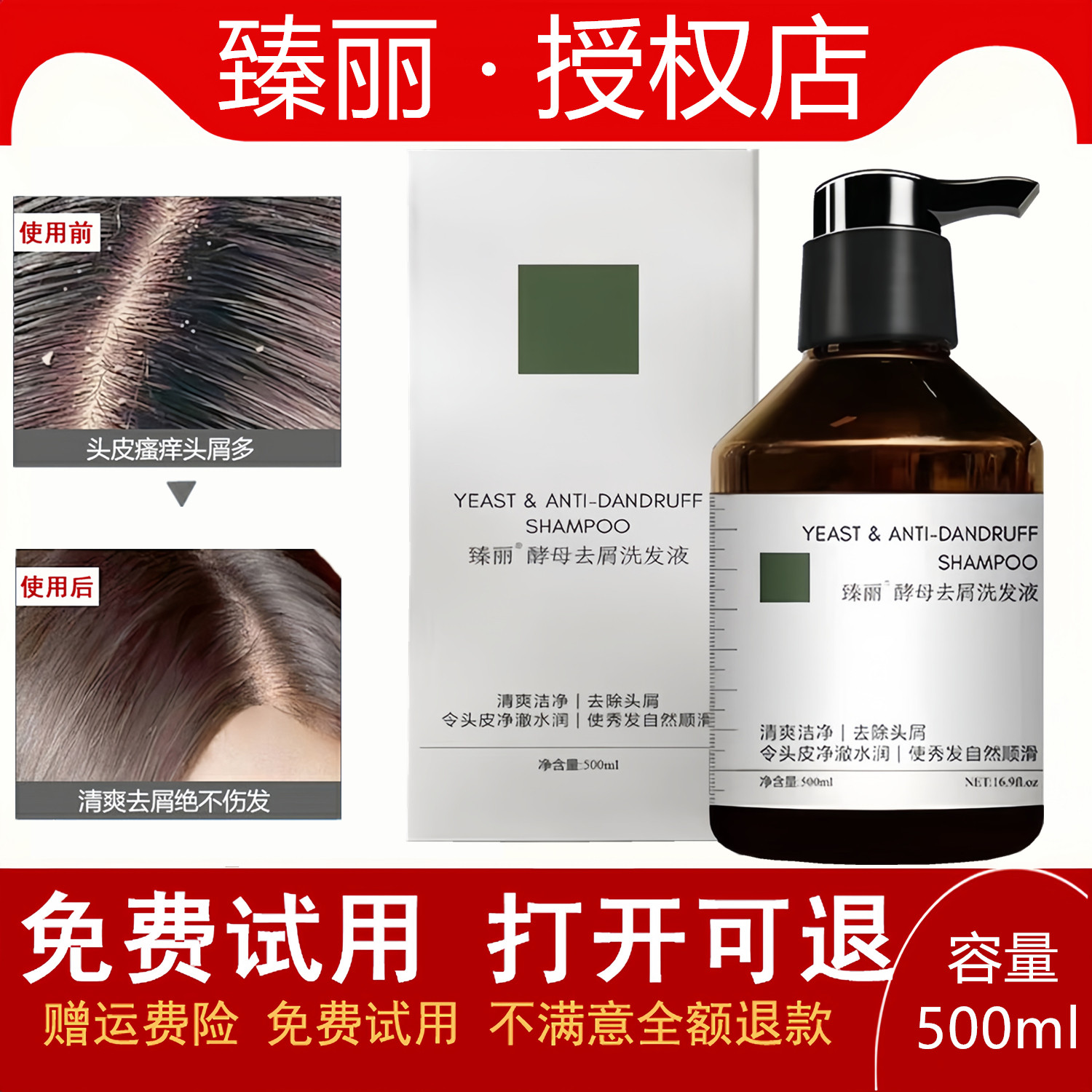 臻丽酵母去屑洗发液控油洗发水