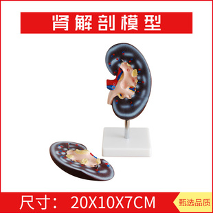 肾解剖模型2件 右肾作额状切面 示肾门 肾血管 输尿管 肾盂 肾脏