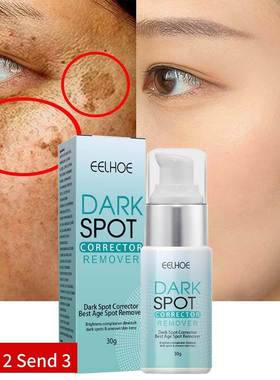 Nicotinamide Whitening Freckle Cream Dark Spot Remover Skin