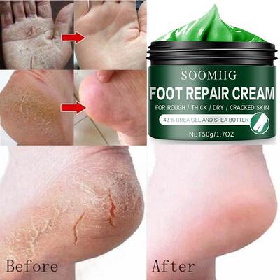 Soomiig Dry and Cracked Foot Cream-Remove Dead Skin and Call