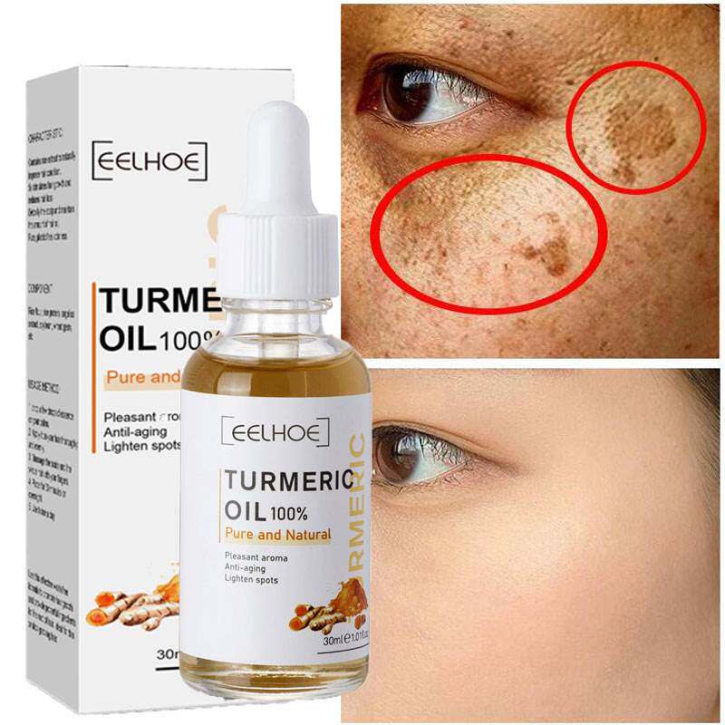 Turmeric Freckle Whitening Serum Curcumin Oil Brighten Fade