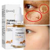 Freckle Oil Whitening Turmeric Serum Curcumin Brighten Fade