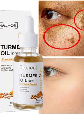 Turmeric Freckle Whitening Serum Curcumin Oil Brighten Fade