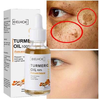 Turmeric Freckle Whitening Serum Curcumin Oil Brighten Fade