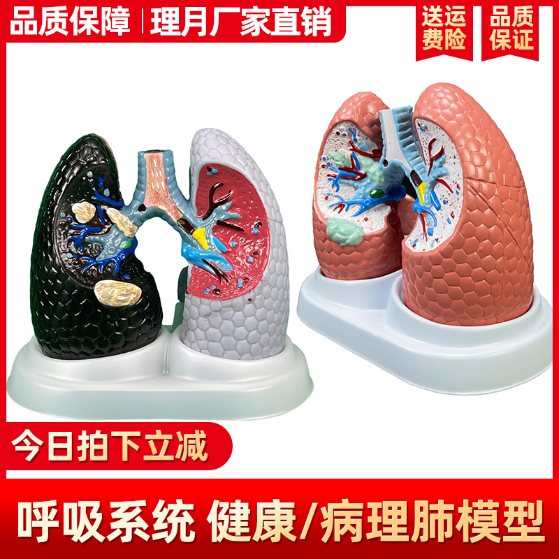 理月人体肺解剖模型呼吸科标本肺