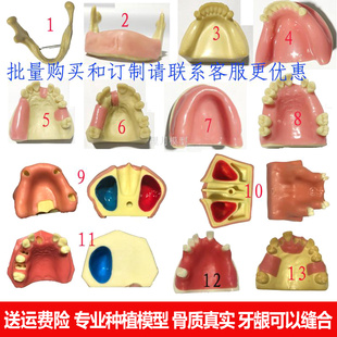口腔备牙牙科种植材料实操练习上颌窦提升下颌骨软牙龈材料牙模型
