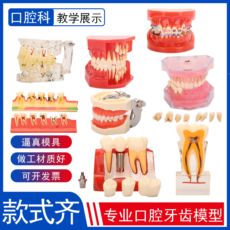 牙齿模型口腔医院教学正畸种植修复可拆卸蛀坏龋假牙科摆件道具-封面