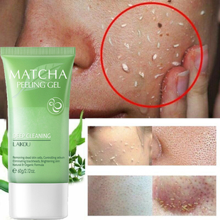 Gel Exfoliating 60g Scrubs 去角质凝胶面部磨砂祛痘控油Facial