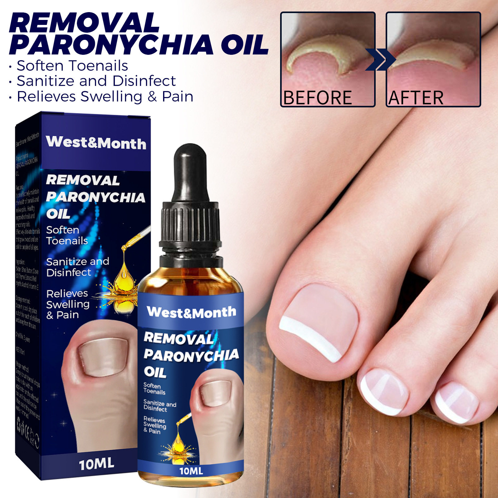 West&Month removal paronychia oil soften toenails Putty Nail